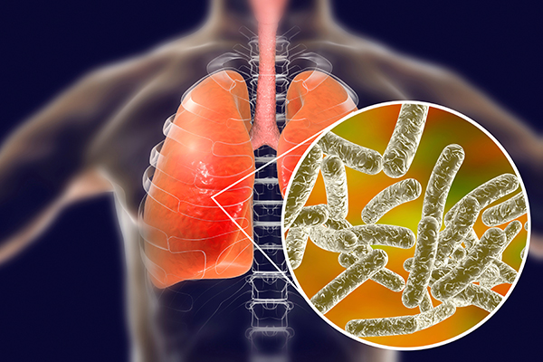 lungs with legionella bacteria